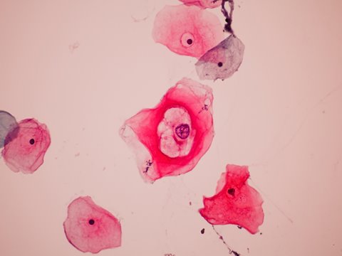 Cervical Screening